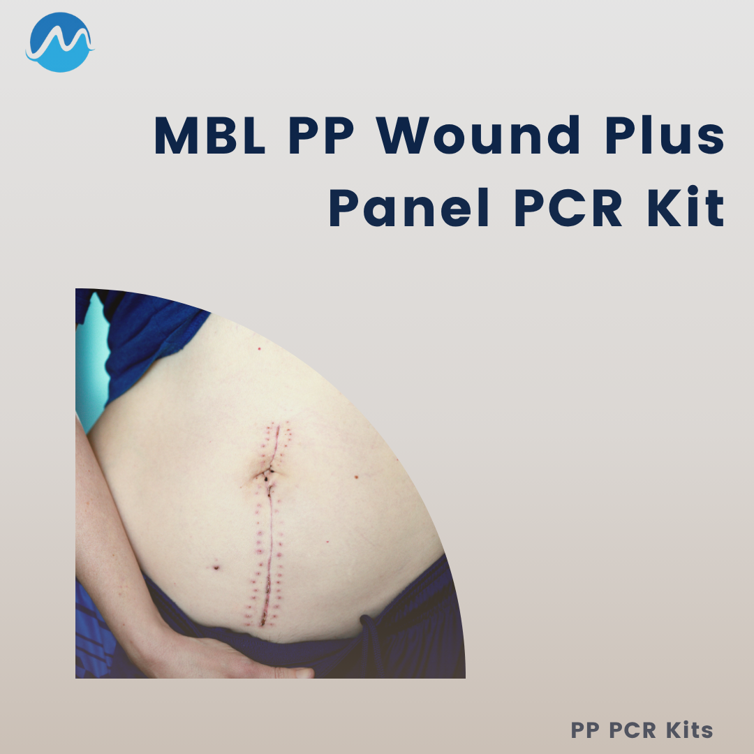 MBL PP Wound Plus Panel PCR kit - 48rxn/Kit