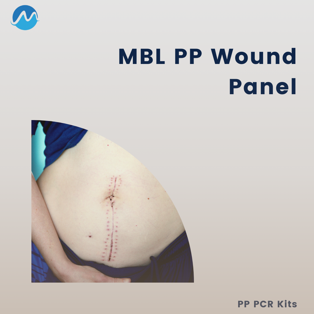 MBL PP Wound Panel - 48 Rxn/kit