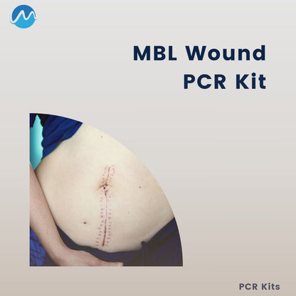 Wound PCR kit